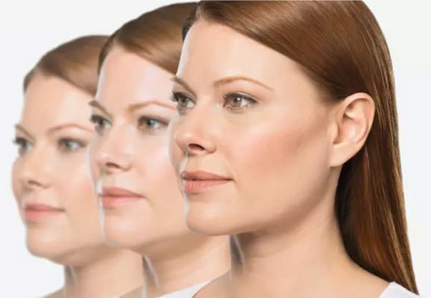 KYBELLA® (deoxycholic acid), the first and only FDA-approved injectable treatment to reduce fat under the chin.