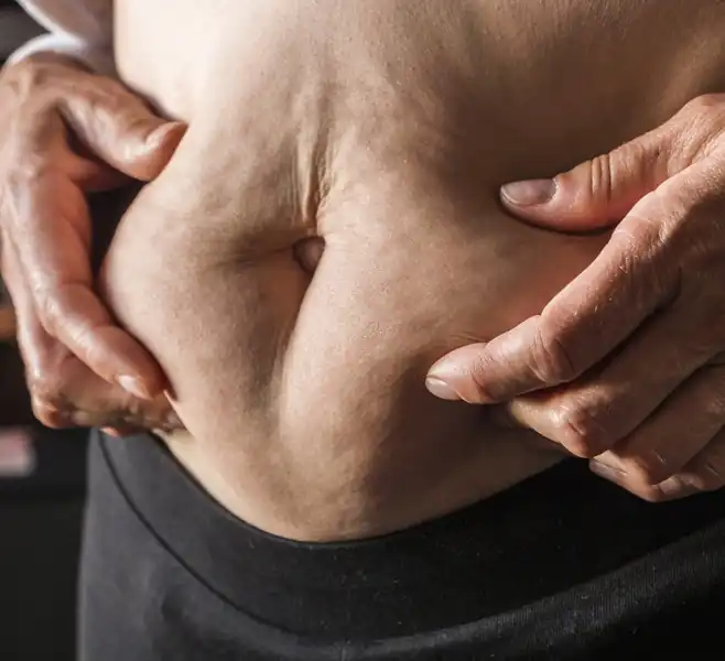 Senior individual squeezing loose skin on her stomach